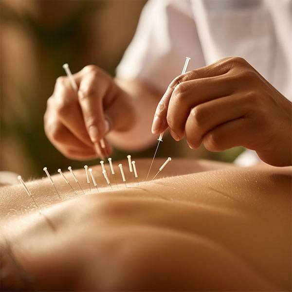 Can Acupuncture Help with Chronic Pain? Here's What You Need to Know